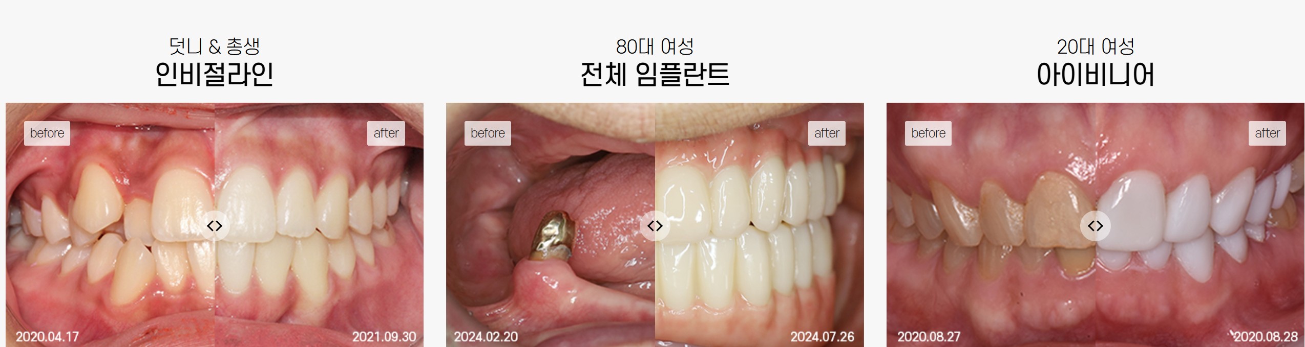 강남 더뉴치과 병원 사진 3